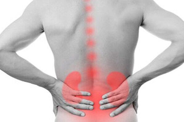 Patologije bubrega mogu izazvati pojavu bolova u donjem dijelu leđa