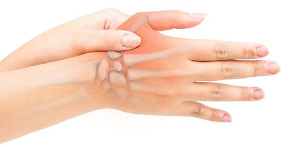 Stenozirajući ligamentitis zaključava prst u savijenom položaju
